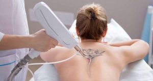 Mit einer Laserbehandlung können unerwünschte Tattoos entfernt werden. Das ist allerdings oft langwierig und schmerzhaft. Foto: djd/www.galenpharma.de/Adobe Stock/4frame group