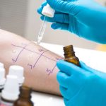 Hyposensibilisierung: Mit einem Allergietest lässt sich ermitteln, welche Pollen die Beschwerden auslösen. Dann kann eine spezifische Immuntherapie geplant werden.