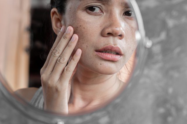 Asian woman checking face with dark spot in mirror