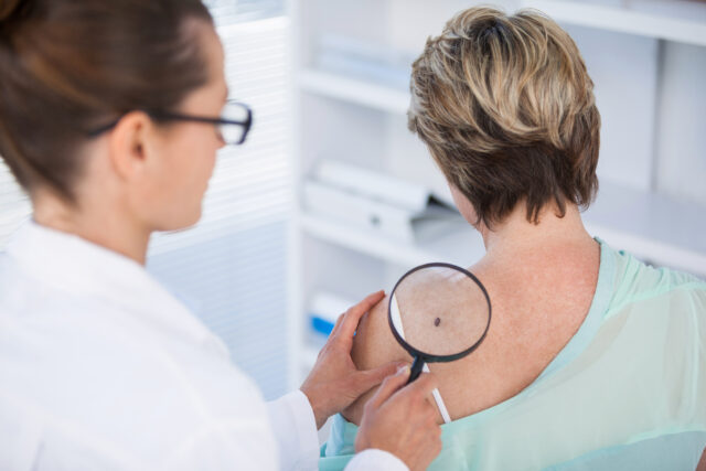 Dermatologist examining mole of female patient with magnifying glass